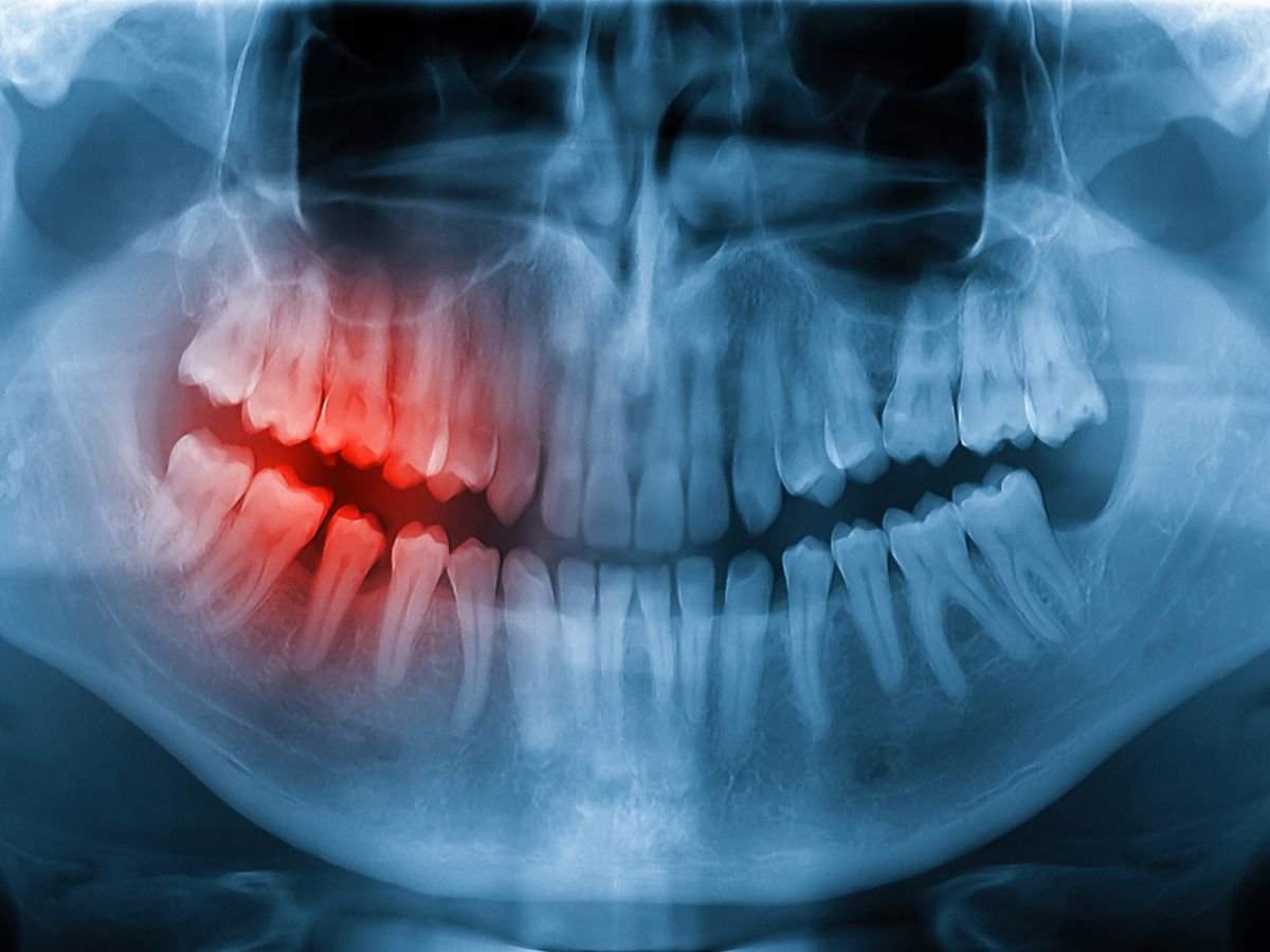 walk-in dental emergency service in odenton, MD